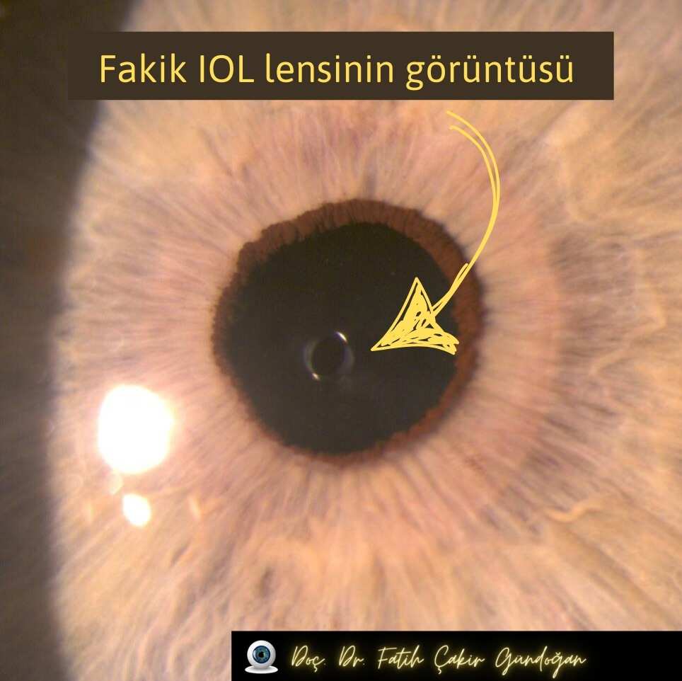 Gözlerden Seçmeler